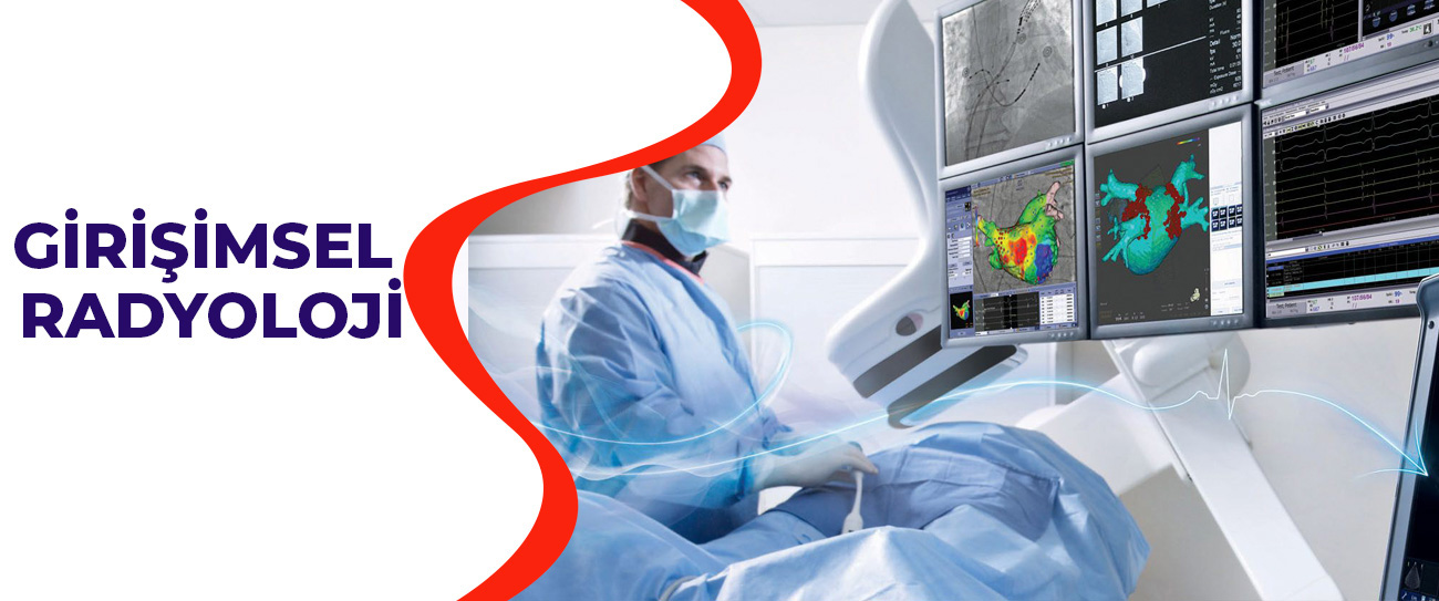 girişimsel radyoloji
